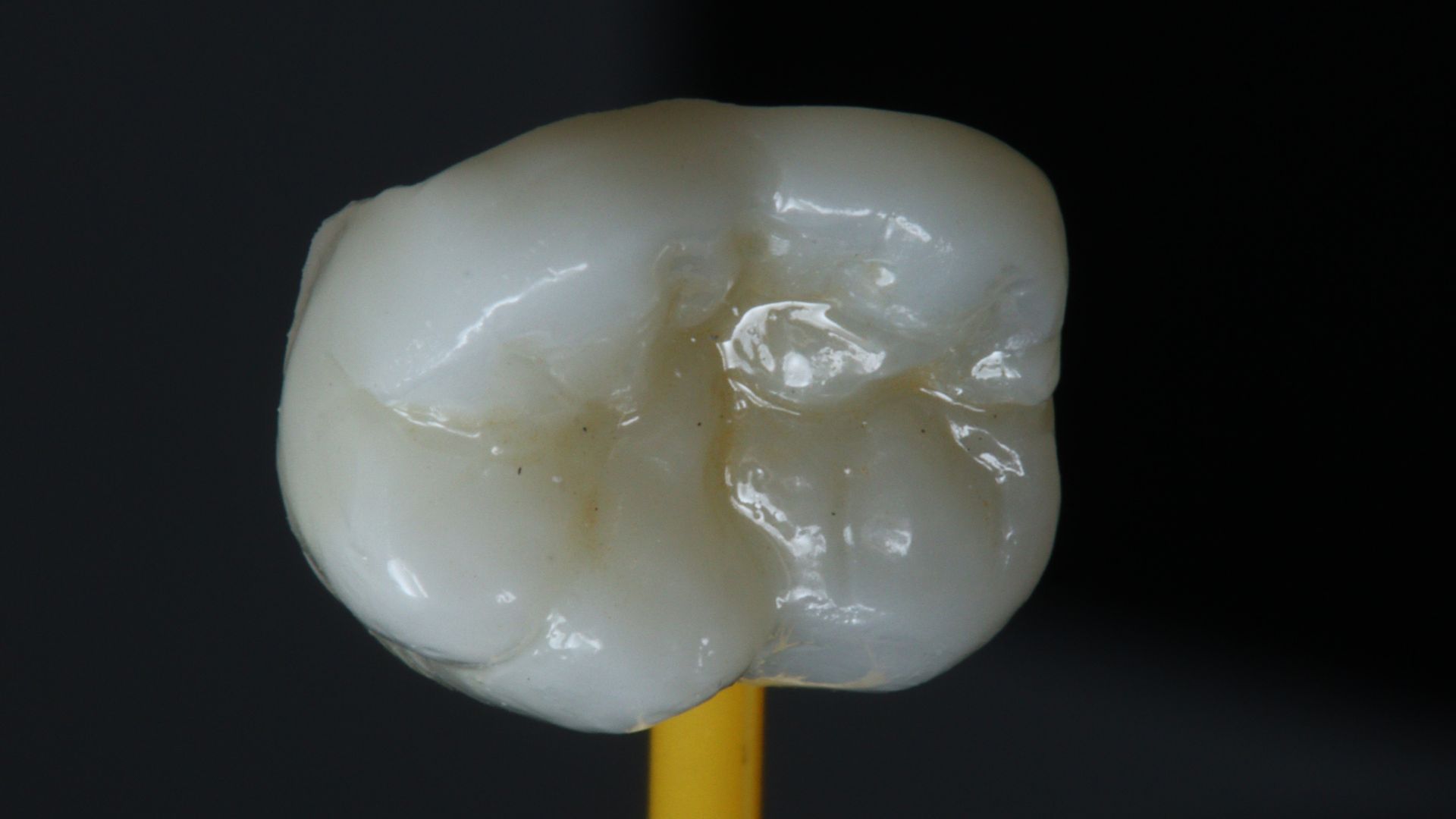 treatment index image