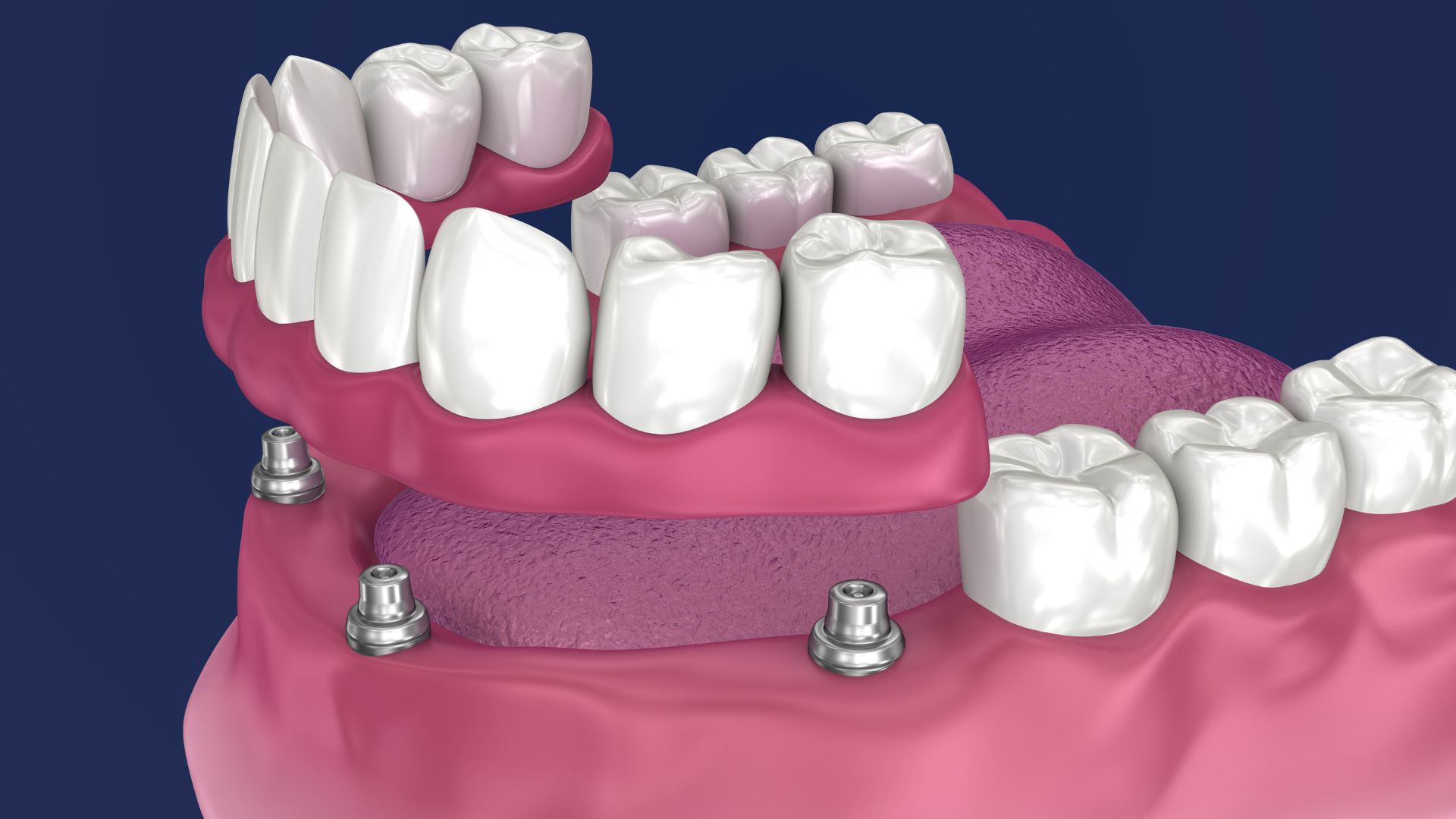 treatment index image